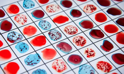 Araştırma: Kan gruplarının karakterimize etkileri