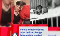 Dünyanın en yaşlı yapışık ikizleri öldü